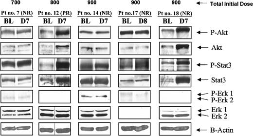 Figure 5. Effects of R115777 on the levels of P-Akt/Akt, P-STAT3/STAT3, P-Erk1/2/Erk1/2, and β-actin in PBMCs from patients with MDS. PBMCs were processed for Western immunoblotting and probed with antibodies against phosphorylated and total Akt, STAT3, and Erk1/2, as described in “Patients, materials and methods.” β-Actin was used as loading control. BL, D7, and D8 indicate baseline and days 7 and 8 after R115777 treatment initiation.