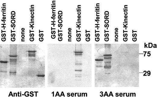 Figure 1. Representative Western blot analysis of cloned gene protein products using anti-GST monoclonal antibody and sera from 2 AA patients. GST fusion proteins were induced by IPTG, separated by 10% SDS-PAGE, and transferred to PVDF membranes. Triplicates of membranes were prepared and probed with mouse anti-GST monoclonal antibody, patient 1AA serum, or patient 3AA serum. Immunoreactive proteins were detected with horseradish peroxidase-conjugated goat antimouse or human IgG secondary antibody.