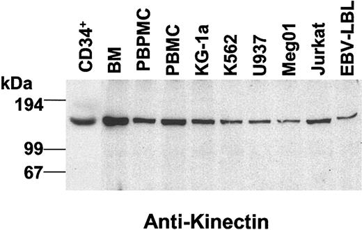 Figure 2. Expression of human kinectin in hematopoietic cells and cell lines. Equal amounts (25 μg) of total lysates were separated by 7.5% SDS-PAGE, transferred to PVDF filters, and probed with mouse antikinectin monoclonal antibody. Immunoreactive proteins were detected with horseradish peroxidase-conjugated goat antimouse IgG secondary antibody.