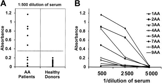 Figure 3. Representative ELISA results. (A) ELISA reactivities of sera from 12 AA patients and 16 healthy donors against purified His-tagged kinectin were measured at a 1:500 dilution. A positive reaction is defined as an absorbance value exceeding the mean OD absorbance value of sera from healthy donors by 3 SDs. (B) Sera from 8 AA patients were serially diluted, and ELISA reactivities were measured against purified His-tagged kinectin.