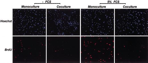 Figure 1. Inhibiting VSMC proliferation in coculture. VSMCs were cocultured with LPS-treated monocytes and were treated with BrdU to analyze DNA synthesis. Incorporation of BrdU was detected by immunofluorescence using monoclonal antibody against BrdU (bottom panels). DNA was counterstained with Hoechst 33258 (top panels). The above stainings were performed in serum-treated and nontreated samples, and VSMCs in monoculture was the control. Original magnification × 200.