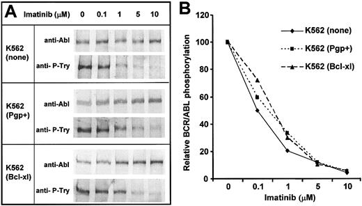 Figure 4. Effect of imatinib on BCR/ABL tyrosine phosphorylation in parental and transduced K562 cells. K562 cells overexpressing the indicated proteins were incubated with various concentrations of imatinib for 2 hours and then lysed and phosphorylation of BCR/ABL analyzed. (A) Whole-cell lysates were resolved by electrophoresis and probed by Western blotting with detection by chemifluorescence for p210 BCR/ABL using antibody to c-Abl, and for tyrosine phosphorylated p210 using antiphosphotyrosine Mabs. (B) Bands were quantitated using Typhoon and analyzed using ImageQuant software (Amersham Biosciences, Buckinghamshire, United Kingdom). The ratios of tyrosine phosphorylated and total p210 for each treatment were calculated after correction for background. Data are expressed relative to the value for each cell line in the absence of drug.