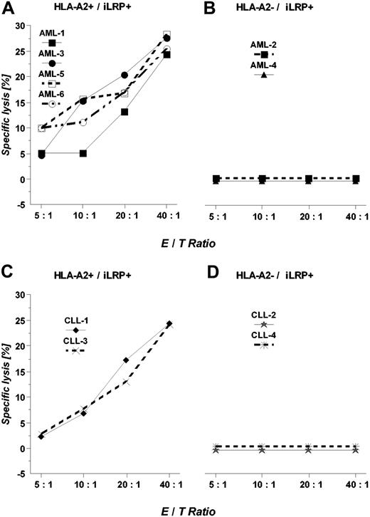 Figure 4. Lysis of primary AML blasts and malignant B-CLL cells endogenously expressing OFA-iLRP. HLA-A2+/OFA-iLRP+ leukemic blasts (A; AML 1, 3, 5, 6), HLA-A2-/OFA-iLRP+ blasts (B; AML 2, 4), HLA-A2+/OFA-iLRP+ B-CLL cells (C; CLL1, CLL3), and HLA-A2-/OFA-iLRP+ B-CLL cells (D; CLL2, CLL4) were used as targets in a 4-hour 51Chromium release assay. One representative experiment is shown.