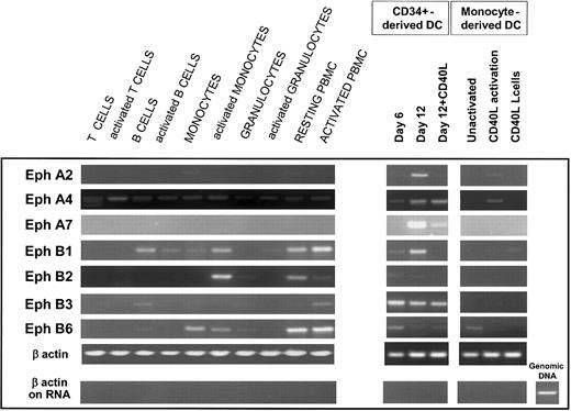 Figure 1. CD34+-derived DCs express high levels of mRNA for Eph receptors. (Left) RT-PCR analysis of Eph expression in hematopoietic cells. cDNA was prepared from unactivated and PMA-ionomycin-activated freshly isolated PBMCs, blood T cells, and monocytes, tonsil B cells, or granulocytes generated in vitro. Monocytes, granulocytes, and B cells were resting or activated with PMA-ionomycin for 1 hour and 6 hours and pooled. T cells and PBMCs were activated with PMA-ionomycin for 6 hours. (Right) RT-PCR analysis of Eph expression in CD34+-derived DCs and monocyte-derived DCs generated in vitro. cDNA was prepared from cord blood CD34+ progenitors cultured in the presence of GM-CSF and TNF-α for 6 and 12 days, and for an additional 4 days with CD40L L cells, from monocytes cultured in the presence of GM-CSF and IL-4 for 6 days (unactivated), after 24-hour activation with CD40L L cells, or as a control from CD40L L cells. RT-PCR was carried out under standard conditions using 50 ng cDNA for 35 cycles. All cDNA samples were normalized according to the results of β-actin PCR amplification of 21, 28, and 35 cycles (only the amplification of 28 cycles is shown). The absence of genomic contamination was controlled in all RNA samples (before the reverse transcription step) by PCR amplification of β-actin with primers designed to amplify genomic DNA, as shown in the lower panel. Results are representative of 3 independent RT-PCR samples.