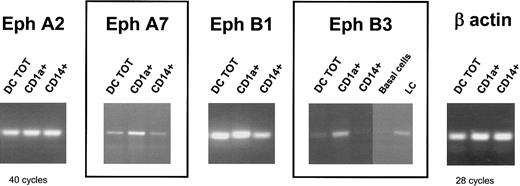 Figure 2. Eph expression in different subsets of CD34+-derived DCs generated in vitro and of skin Langerhans cells isolated ex vivo. Cord blood CD34+ progenitors were cultured in the presence of GM-CSF, SCF, TNF-α, and 2.5% AB+ human serum. At day 6, CD1a+ and CD14+ precursors were sorted by flow cytometry and recultured with GM-CSF and TNF-α for 6 additional days. The presence of Eph transcripts in the 2 purified subsets was compared to total CD34+-derived DCs (DC TOT, corresponding to unsorted cells). cDNA was prepared from basal cells and from Langerhans cells, freshly isolated from normal skin. RT-PCR was carried out under standard conditions using 50 ng cDNA for 40 cycles. All cDNA samples were normalized according to the results of β-actin PCR amplification of 21, 28, and 35 cycles (only the amplification of 28 cycles is shown). Results are representative of 3 independent RT-PCR samples.