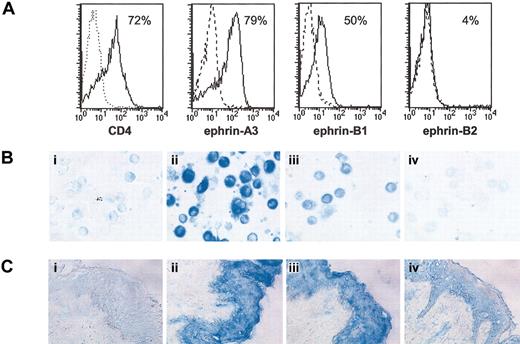 Figure 6. Expression of several Eph ligands in normal skin (ephrin-A3, ephrin-B1, and ephrin-B2). (A) Expression of ephrin-A3, ephrin-B1, and ephrin-B2 by day-11 CD34+-derived DCs cultured in the presence of GM-CSF and TNF-α. Ephrin-A3, ephrin-B1, and ephrin-B2 expression was analyzed by cytofluorometry with anti-ephrin-A3 (K19), anti-ephrin-B1 (C18), or anti-ephrin-B2 (P20) polyclonal antibodies directed against intracytoplasmic epitope, after DC permeabilization with saponin, as described in “Materials and methods.” Dotted-line overlay histograms show negative fluorescence control with an antibody of unrelated specificity, and bold dotted-line overlay histograms represent staining after addition of the blocking peptides. (B) Immunocytochemistry analysis of ephrin-A3 (ii), ephrin-B1 (iii), and ephrin-B2 (iv) on day-11 CD34+-derived DC cytospins. Staining was performed with anti-ephrin-A3 (K19), anti-ephrin-B1 (C18), or anti-ephrin-B2 (P20) polyclonal antibodies. The specificity of the staining was confirmed by the absence of detection in the presence of the immunization peptide (data not shown). The negative control (i) represents a polyclonal antibody of unrelated specificity. (C) Immunohistochemistry analysis of ephrin-A3 (ii), ephrin-B1 (iii), and ephrin-B2 (iv) expression in vivo. Staining was performed on normal serial skin sections with anti-ephrin-A3 (K19), anti-ephrin-B1 (C18), or anti-ephrin-B2 (P20) polyclonal antibodies. The negative control (i) represents a polyclonal antibody of unrelated specificity (original magnification × 200 for B and C).