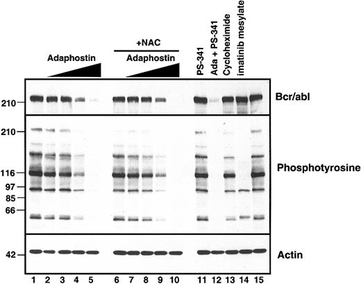 Figure 4. Adaphostin-induced Bcr/abl down-regulation is not affected by NAC. After 15 minutes of pretreatment with diluent (lanes 1-5) or 24 mM NAC (lanes 6-10), adaphostin was added to a final concentration of 0 (lanes 1 and 5), 1.25 (lanes 2 and 6), 2.5 (lanes 3 and 7), 5 (lanes 4 and 8), or 10 μM (lanes 5 and 10). Whole-cell lysates were prepared 8 hours later and subjected to SDS-PAGE followed by immunoblotting with antibodies that recognize c-abl (upper panel), phosphotyrosine (middle panel), or actin as a loading control (lower panel). In lanes 11-15, as controls, cells were treated with the proteasome inhibitor bortezomib (PS-341) at 50 nM in the absence or presence of 10 μM adaphostin, with 100 μM cycloheximide, or with 5 μM imatinib mesylate for 8 hours.