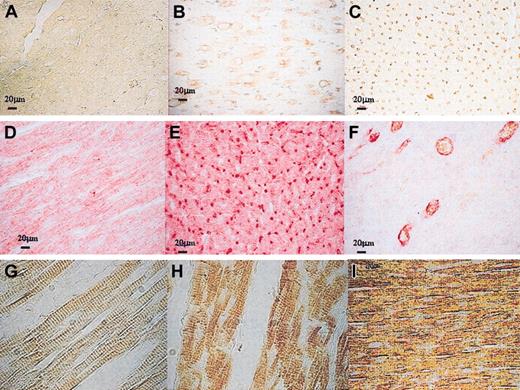 Figure 6. Markers of proliferation and of differentiating cardiac cells. (A-C) Immunophenotypic characterization of cells of endothelial lineage demonstrated in treated animals versus control animals (A), diffuse increase in capillaries (B) > 100 micrometer diameter or (C) of 12 to 100 micrometers; (D-F) double immunostaining showed that cycling Ki67+ cells expressed FVIII (Ki67 appeared in brown and was revealed by DAB-peroxidase reaction and FVIII appeared in red and was revealed by Fastred-alkaline phosphatase reaction) (F), most of endothelial lineage cells did not express Ki67 (E), control animals (D). (G-I) In the healthy myocardium, cardiac myocytes are characterized by the organization of the contractile proteins into striated myofibrils, resulting from repeating units arranged in series, the sarcomeres (G). Myosin was expressed in some sections of the infarcted area, but a disorganization of cardiac sarcomeres was observed in treated animals (H) as well as in control animals (I). Original magnifications: A-F, × 40; G-I, × 60.
