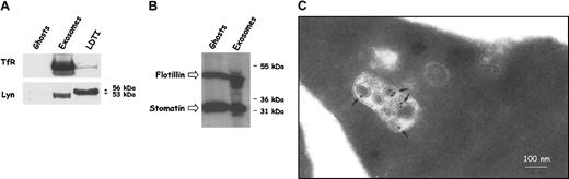 Figure 1. Presence of raft markers in reticulocyte exosomes. (A) Equivalent protein amounts of ghosts, exosomes, and LDTI membranes from rat reticulocytes (exceeding 70%) were loaded on 10% SDS-PAGE and analyzed by Western blotting for Lyn and the TfR. (B) Because of GARP-50 antibody specificity, human red cells (6% reticulocytes) were subcultured in vitro. Red cell ghosts and exosomes collected from the medium were analyzed by Western blotting for human stomatin (GARP-50) and then for flotillin. (C) Rat reticulocytes (40 μL packed cell volume) were incubated with (50 μg/mL) biotinylated B-subunit of cholera toxin (bCTXB) for 3 hours at 4°C and chased for 60 minutes at 37°C. Cells were then fixed in 2% paraformaldehyde and processed as described in “Materials and methods.”
