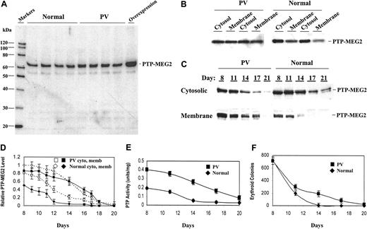 Figure 3. Protein level, distribution, and activity of PTP-MEG2 in normal and PV ECFCs and the correlation with in vitro ECFC development. Normal and PV ECFCs were cultured in conditioned liquid medium and analyzed at the indicated times. (A-C) Whole-cell extracts (A) or cytosolic and membrane fractions (B-C) of day 6 (A-B) or day-8 to -21 (C) ECFCs from different PV patients and healthy volunteers were subjected to Western blot analyses with anti-PTP-MEG2 antibody. The far right lane in panel A represents extracts from normal day-6 ECFCs infected with retrovirus carrying PTP-MEG2 (Figure 4A). (D) Quantitative representation of the protein level of PTP-MEG2 (based on gel scanning) in cytosolic (open symbols) and membrane (closed symbols) fractions of day-8 to day-20 PV (▪) and normal (♦) ECFCs. Data represent the average of at least 4 experiments with different PV and normal samples. (E) PTP activity in the membrane extracts of day-8 to day-20 PV (▪) and normal (♦) ECFCs. (F) For erythroid colony-forming assays, 1000 day-8 to day-20 PV (▪) and normal (♦) ECFCs were seeded in semisolid methylcellulose medium under optimal culture conditions. Erythroid colonies were counted after 10 days of culture.