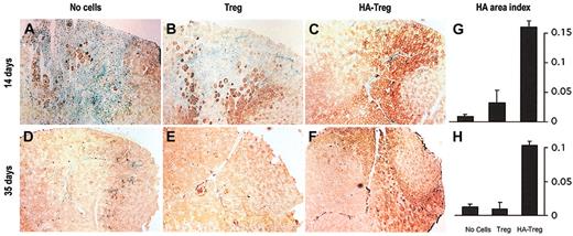 Figure 2. HA-specific CD4+CD25+ cells allow transgene engraftment in transduced muscle. BALB/c mice were injected intramuscularly at day 0 with AAV-HA, and were either untreated (A,D) or injected intravenously at days 0 and 4 with 106 CD4+CD25+ cells from BALB/c mice (B,E) or CD4+CD25+ cells from TCR-HA mice (C,F). At days 14 (A-C) and 35 (D-F), muscles were frozen and HA expression was assayed by immunohistochemistry using horseradish peroxidase (HRP)/diaminobenzidine (DAB) staining in brown on sections counterstained with methyl green, which stains the nuclei of muscle and infiltrating lymphoid cells in blue/green. Images are representative of 3 mice per group. Original magnification × 40. Quantification of HA expression was assessed by computer-assisted image analysis (Histolab; Microvision Instruments, Evry, France). For each mouse in each condition, 5 to 10 entire transverse sections of tibialis anterior were measured. The total section and HA-positive areas were determined by image texture and HRP/DAB color analysis, respectively. The reproducibility of image analysis was controlled using normal muscle sections as a standard on each slide. Results are expressed as an index of HA-positive area over the total tibialis anterior area and represent the mean ± SEM of 3 mice per group, at days 14 (G) and 35 (H).