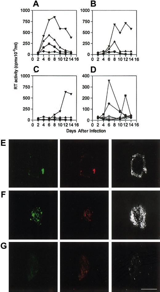 Figure 3. Influence of α1PI on HIV-1 infection kinetics in serum-free medium. To examine whether α1PI might exert its influence on virus or cells, cells were cultured overnight in serum-free medium and infected with varying doses of virus in the presence of varying concentrations of α1PI. To avoid biasing the outcome against adherent cells, U937 clones were infected directly in microplates. For comparison, cells were infected in microtubes, washed to remove free virus, and transferred to clean wells of a microplate. In vitro infectivity of HIV-1 permissive clone 10 was significantly increased in the presence of increasing concentrations of α1PI. Clone 17 failed to be infected at any viral dose or any concentration of α1PI. Cells were infected with HIV-1NL4-3 using (A) 1 × 10-2 MOI, (B) 1 × 10-3 MOI, or (C) 1 × 10-4 MOI. Clone 10 infected in the absence of α1PI (•) was equivalent to infectivity in the presence of 0.3 μM α1PI (▪) and increased in the presence of 3 μM (▴), or 30 μM (▾) active α1PI. Clone 10 exhibited low RT activity when cells were infected in microfuge tubes and transferred to wells of a tissue-culture plate in any concentration of α1PI (♦). Infectivity experiments were confirmed independently by the Laboratory of Immunoregulation, NIAID, NIH. A representative set of results is depicted. Infectivity outcome was determined in duplicate by measuring RT activity of cell-free supernatants. Mean values are depicted. (D) RT activity produced by clones 10 and 17 infected simultaneously in the presence (closed symbols), but not in the absence (open symbols), of α1PI is represented. RT activity was produced by HIV-1 nonpermissive clone 17 following pretreatment with LPS and LBP (▾). Cells infected in the presence of LPS and α1PI and the absence of LBP (▪) produced diminished peak RT activity and prolonged time to peak activity. RT activity was not produced by clone 17 in the absence of LPS and LBP even though α1PI was present (♦). Peak RT activity produced by clone 10 infected in parallel is represented for comparison (•). To examine colocalization of HIV-1 with receptors, clone 10 was incubated with HIV-1NL4-3 in serum as a source of α1PI. At 15-minute intervals, cells were washed free of virus, fixed, and slides were prepared. Following incubation for 15 minutes with HIV-1NL4-3, (E) HLE (green), CD4 (red), and HIV-1 (silver) were copatched, and (F) HLE (green), CXCR4 (red), and HIV-1 (silver) were copatched. (G) Copatching of HLE (green), CD4 (red), and HIV-1 (silver) on clone 10 was not detected in the absence of HIV-1NL4-3. HIV-1 coreceptors were detected by CLSM using polyclonal anti-HLE, monoclonal anti-CD4, and monoclonal anti-HIV specific for epitopes proximal to the V3 loop. Bar represents 30 μm. HIV-1 infectivity and CLSM were performed at least 3 times and representative data are presented.