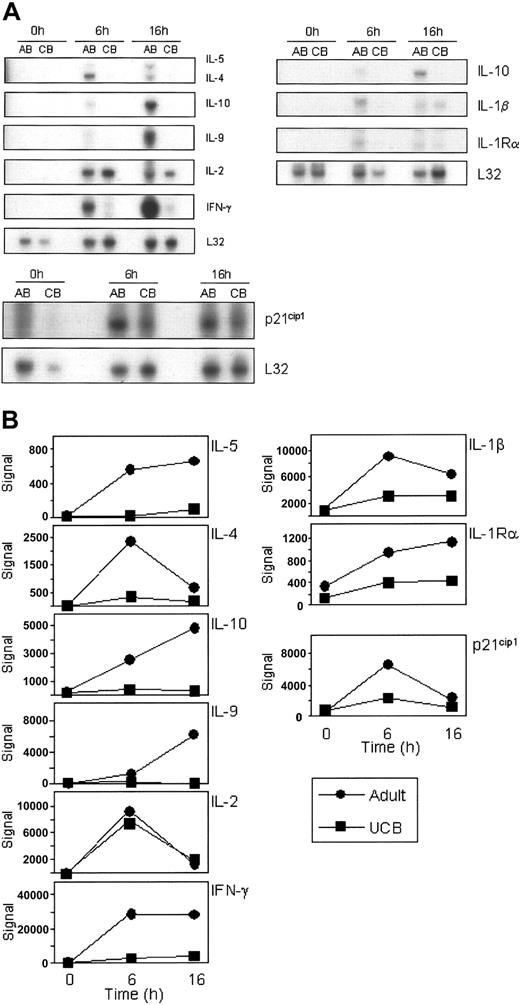 Figure 2. Corroboration of differential mRNA expression of selected probes by multiprobe RNase protection analysis. The same total RNA pools used for the gene array studies were analyzed for mRNA expression by RNase protection arrays (A). Five micrograms of each pool of RNA was used per hybridization to hCK1, hCK2b, and hStress multiprobe templates. Exposure times varied among the gels depending upon the strength of each signal. L32 mRNA is included as a control for input RNA. Representative results from 2 to 3 repeat experiments are shown. (B) Microarray expression data from the HG-U133A&B array corresponding to the above genes were graphed individually, showing the raw signal. ▪ indicates UCB; and •, adult.