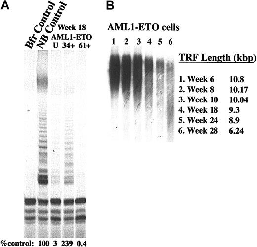 Figure 6. CD34+ AML1-ETO-expressing cells retain telomerase activity and maintain telomere length. (A) Telomerase activity was assayed on cells selected for CD34 and CD61 expression by magnetic beads. Per lane, 2 × 105 cells were used (2 × 104 cells in the CD34+ sample). The neuroblastoma cell line served as a positive control (NB) and lysis buffer alone was used as the negative control. (B) To assess telomere length, 2 μg purified DNA was digested with restriction enzymes HinfI and RsaI, separated on 0.8% agarose gel, transferred to a nylon membrane, and probed with a digoxigenin-labeled probe specific for telomeric repeats. A digoxigenin-specific antibody, covalently coupled to alkaline phosphatase, was used for detection.