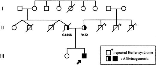 Figure 1. Family tree. The arrow indicates the proband. Apart from the father (II.4) who died from a presumed myocardial infarction, no history of abnormal bleeding or thrombosis was reported on either side of the family (individual II.2 died in an accident at age 34; individual II.3 died close to birth). The mother's 3 brothers (II.6, II.7, and II.8) died from reported Hurler syndrome. □ = male; ○, female; and /, deceased.