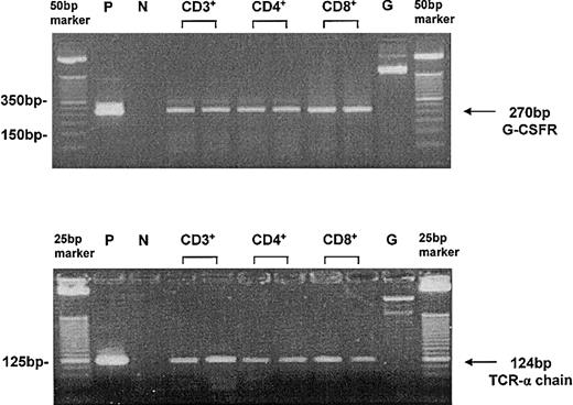 Figure 1. Single-cell RT-PCR for G-CSFR expression in T cells after G-CSF treatment in vivo. T cells were freshly isolated by microbead technology (purity > 98%) and single cells were handpicked under microscopic control using a microcapillary system. The leukemia cell line U937 served as a positive control (P). The application of exon–intron spanning primers allowed the discrimination from genomic amplification (G) of the G-CSFR (top blot). Because of the coamplification of the T-cell receptor α (TCR-α) chain, the analyzed cells could be identified as T cells (bottom blot). Peripheral T cells served as a positive control. Efficiency of single-cell RT-PCR for G-CSFR and for TCR-α chain was higher than 90%. P indicates positive control; N, negative control; and G, genomic amplification.