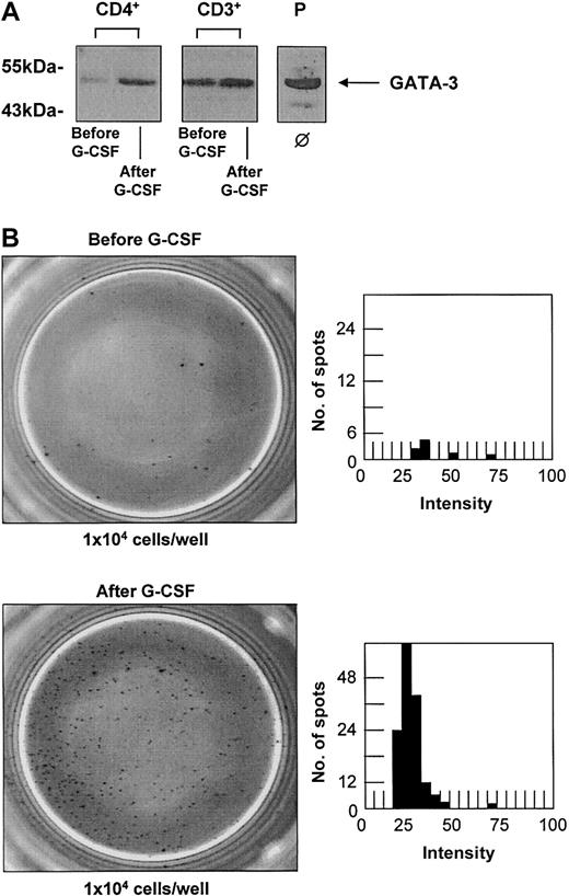 Figure 3. G-CSF treatment in vivo leads to an up-regulation of GATA-3 and increase of spontaneous IL-4 secretion in T cells. G-CSF treatment in vivo leads to an up-regulation of GATA-3 and an increase of spontaneous IL-4 secretion in T cells of healthy stem cell donors. (A) Western blot analysis of CD3+ and CD4+ T cells confirmed the up-regulation of GATA-3 upon G-CSF treatment in vivo at the protein level in 6 individual donors with increases up to 1.8-fold in CD3+ and 2.6-fold in CD4+ T cells (Western blots of representative donors are shown). The T-cell leukemia cell line MOLT-4 served as a positive control (P). ϕ indicates no in vitro stimulation. (B) The production of IL-4 as representative cytokine for a Th2 immune response was quantified in CD3+ T cells before (top panels) and after (bottom panels) G-CSF treatment by ELISPOT analysis. PHA-stimulated PBMCs served as a positive control, and cell-free medium served as a negative control. The number of spot-forming units is shown in dependence of their intensity determined by ELISPOT Reader Software. G-CSF treatment resulted in a 10- to 20-fold increase of spontaneous IL-4 secretion by CD3+ T cells in 3 different donors analyzed (1 representative donor is shown). Original magnification, × 20.