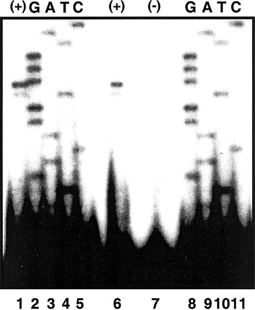 Figure 3. Primer extension of ALAS2 poly (A)+ RNA. Electrophoretic separation of primer extension products was carried out in denaturing polyacrylamide gel electrophoresis as described in “Patients and methods.” Lanes 1 and 6 are primer extension products of poly (A)+ RNA by an ALAS2 exon 1 primer. Lane 7 is an extension control with no template. Lanes 2 to 5 and 8 to 11 are sequencing extension products from a genomic ALAS2 clone.