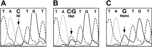 Figure 4. Fluorescent dideoxy sequence analysis of the ALAS2 gene promoter. The bases are distinguished by heavy solid lines (G), light solid lines (A), dashed lines (T), and dotted lines (C). Panel A shows healthy female control; panel B, heterozygous female (proband); and panel C, hemizygous son of the proband. The mutated base is indicated by an arrow.