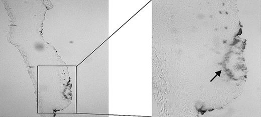 Figure 2. Presence of heme. The presence of heme in a fresh wound of a Wistar rat was analyzed using benzidine staining. The heme (arrow) has clearly accumulated at the sites of injury. Original magnification, × 100 (left panel) and × 265 (right panel).