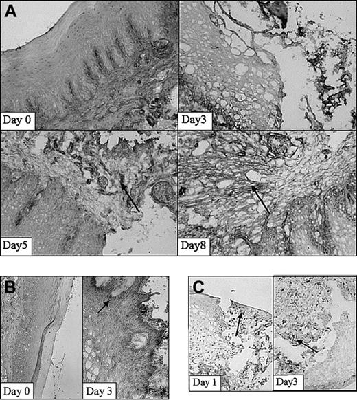 Figure 3. Adhesion molecule expression and the infiltration of leukocytes. Adhesion molecule expression and the infiltration of leukocytes subset in the wound shown at 2 different stages in wound healing as determined using immunohistochemistry. (A) β1-Integrins are highly up-regulated 5 and 8 days after wounding (arrows; original magnification, × 100). (B) ICAM-1 expression is clearly up-regulated within the wounded tissue at day 3 compared with day 0 (arrow; original magnifications, × 100 and × 250, respectively). (C) Massive infiltrates of macrophages are present 1 and 3 days after wounding. Arrows indicate examples of positive staining (original magnification, × 250).