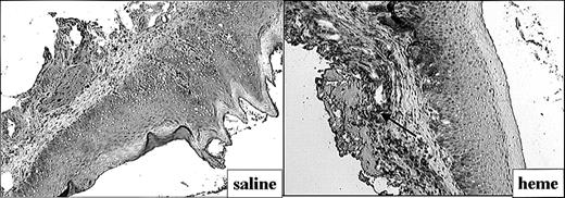 Figure 4. Adhesion molecule expression after administration of saline or heme. Administration of heme prior to injury caused a clear increase in ICAM-1 expression in endothelial cells, infiltrating leukocytes, and keratinocytes (arrow; original magnification, × 100).