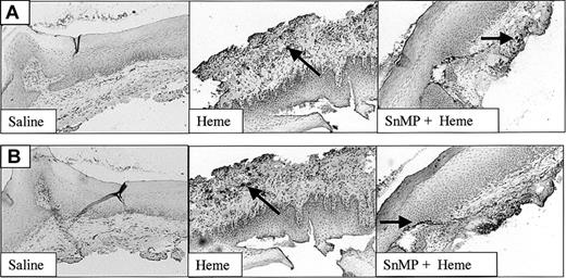 Figure 5. The recruitment of leukocytes after administration of heme, saline, or SnMP. Both infiltrated granulocytes (A) and macrophages (B) are highly up-regulated after administration of heme (arrows). Inhibition of HO activity using SnMP exacerbated heme-induced leukocyte infiltration (original magnification, × 100). In some cases HO inhibition using SnMP alone already caused leukocyte infiltration (data not shown).