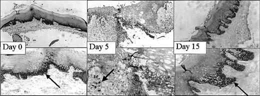 Figure 6. Expression of HO-1 in the mucosa in time. HO-1 is clearly expressed in the epithelium of the mucosa (arrows). Furthermore, at day 5 HO-1 is highly evident in infiltrated leukocytes. At day 15 the expression returned to initial levels (in the top and lower panels, original magnifications are × 100 and × 250, respectively).