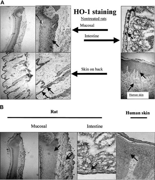 Figure 7. Expression of HO-1 and HO-2 isoforms in mucosa and skin. (A) HO-1 is not exclusively expressed in the oral mucosal epithelium, but also present in the epidermis of skin from the back of a rat and in the intestines (original magnifications, × 100 and × 250, respectively). Furthermore, HO-1 expression is evident in human epidermis and infiltrated leukocytes of a patient suffering from chronic inflammation (arrows; original magnification, × 250). (B) HO-2 is expressed both in the epithelial as well as the dermal layer of mucosa and skin (mucosal, back of the rat, and intestines; arrows; original magnifications, × 100 and × 250, respectively). HO-2 is also expressed in a patient suffering from chronic inflammation.