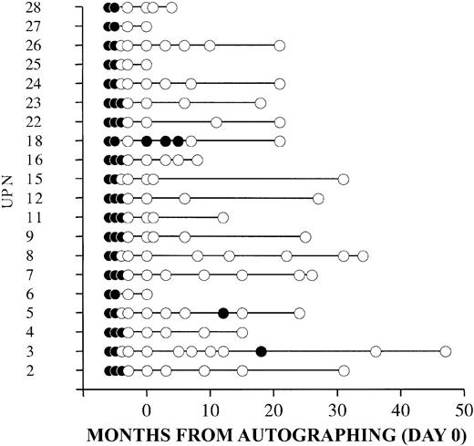 Figure 3. Detection of MRD in bone marrow samples. Results of PCR analysis for the 20 patients in whom a probe for IgH (9 patients) or a bcl-1/IgH rearrangement (11 patients) was available. The analysis was carried out on bone marrow samples obtained at diagnosis, after standard-dose chemotherapy, after cyclophosphamide, after cytarabine, after the second autografting (day 0), and at the indicated follow-up times. • indicates PCR-positive; ○, PCR-negative. UPN indicates unique patient number.