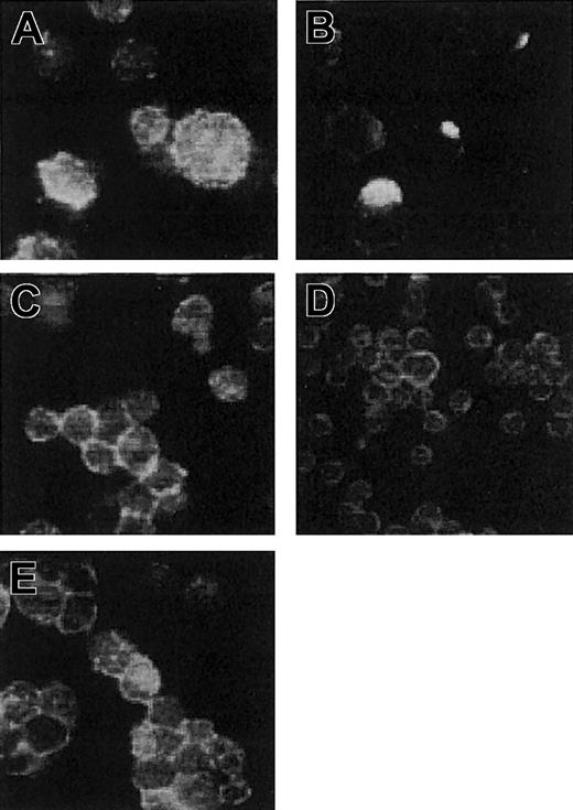 Figure 5. Immunofluorescent analysis of antibody-induced capping of CD28. Jurkat T cells expressing CD28 were incubated in culture medium with 2 μg/mL divalent CD28.3 IgG antibody (A-B) or 2 μg/mL CD28.3 Fab fragments, with 2 μg/mL scFv28.3-HaaT (E) or with 50% Cos cell supernatant containing approximately 4 μg/mL scFv28.3 (D). Cells were incubated for 1 hour at 0°C (A) or at 37°C (B-E), washed in ice-cooled PBS containing NaN3, and centrifuged onto microscope slides. After fixation with 0.5% paraformaldehyde (PFA), CD28 molecules were revealed using FITC-labeled CD28.6, a mAb reacting against an epitope on CD28 other than CD28.3.11 Slides were observed by fluorescence microscopy, and magnification is × 63 for all panels.