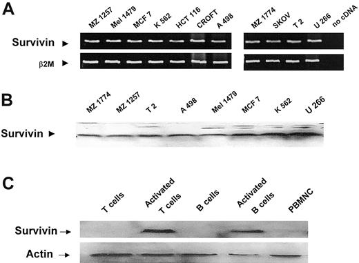 Figure 1. Survivin expression in human tumor cell lines. (A) RT-PCR using survivin-specific primers was performed to analyze the RNA expression of survivin in human tumor cell lines. β2-Microglobulin–specific primers were used as controls. (B) Western blot analysis using a monoclonal antibody against survivin protein. Peripheral blood mononuclear cells (PBMNCs) and purified B and T lymphocytes were included in the analysis of protein expression as controls (C).