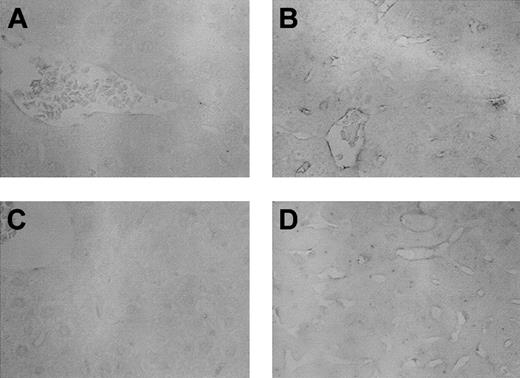Figure 2. Immunohistochemistry of ICAM-1. Liver sections were obtained after BMT at either day 7 or day 35 and tested for the protein for ICAM-1 as described in “Materials and methods.” (A) Day 7 after syngeneic BMT; (B) day 7 after allogeneic BMT; (C) day 35 after syngeneic BMT; and (D) day 35 after allogeneic BMT. ICAM-1 protein was clearly detected in the endothelium of portal vein and hepatic sinusoids after allogeneic BMT (B,D). No unspecific binding of the isotype control was detected (not shown). Methylgreen counterstain; original magnifications, × 400.