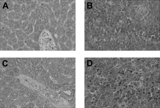 Figure 4. Immunohistochemistry of IFN-γ. Liver (A,C) and spleen (B,D) sections were obtained at day 7 after syngeneic BMT (A-B) and allogeneic BMT (C-D) and tested for IFN-γ protein by immunohistochemistry as described in “Materials and methods.” Abundant IFN-γ protein was detected with peroxidase staining as brown granules in the spleen (D) but not in the liver (C) after allogeneic BMT. IFN-γ staining was detected in neither liver nor spleen from syngeneic BMT (A-B). Methylgreen counterstain; original magnifications, × 400.