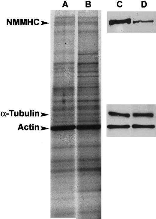 Figure 3. Immunoblotting. SDS-PAGE of total protein extracts (A-B) and immunoblots showing MYH9, total actin, and α-tubulin expression (C-D) in a representative control subject (A,C) and a patient with the Asp1424Asn mutation (B,D). Loading was normalized to total actin concentration.