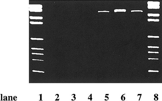 Figure 1. NB1 cDNA in NB1 GP- and NB1 GP+ neutrophils. Qualitative PCR for full-length NB1 cDNA yielded PCR products with only the cDNA isolated from the NB1 GP+ subpopulation: weight standards (lanes 1 and 8), samples of NB1 GP- (lanes 2-4), and NB1 GP+ PMNs (lanes 5-7).