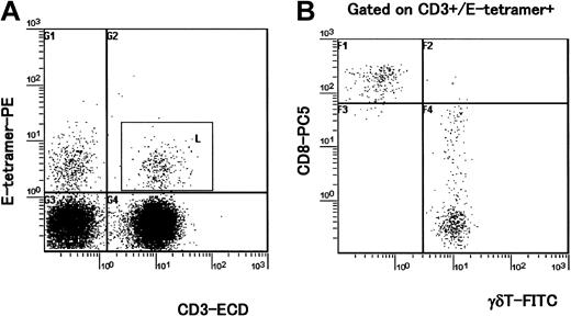 Figure 1. Four-color analysis of HLA-E tetramer–positive T cells. PBMCs isolated from 4 HAM/TSP patients and 5 healthy (uninfected) controls were stained with HLA-E tetramer and with antibodies to CD3, CD8, and the γδ TCR. A representative experiment from one healthy control is shown. (A) PBMCs were stained with E tetramer and anti-CD3 mAb. HLA-E tetramer–positive CD3+ cells were gated (square gate). (B) Dot plot shows expression of CD8 and γδ TCR in CD3+ cells that were HLA-E tetramer–positive (inside square gate on panel A). Staining with a pan anti-γδ TCR mAb indicates that about 70% of HLA-E tetramer–positive/CD3+ cells were CD8high- γδ T cells and almost all CD8high+ cells were γδ- T cells in this individual.