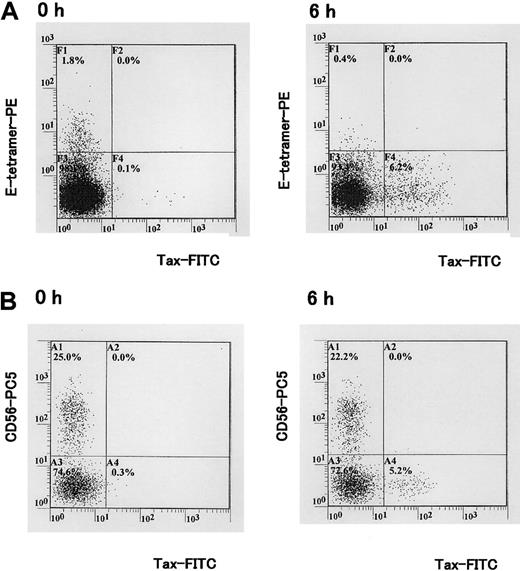 Figure 3. Concomitant detection of HLA-E tetramer ligand, Tax, and CD56 antigens in PBMCs isolated from a HTLV-1–infected individual. (A) PBMCs isolated from a HAM/TSP patient were cultivated for 6 hours in vitro. Tax protein was detected with the Lt-4 mAb. Staining with HLA-E tetramer and Lt-4 is shown. (B) Staining with Lt-4 and CD56-PC5 mAb. One representative experiment of 3 is shown.