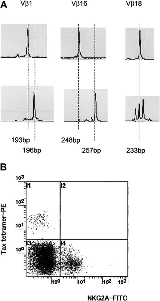 Figure 6. Different TCR usage between HLA-E tetramer–positive T cells and immunodominant Tax11-19–specific CD8+ T cells from HTLV-1–infected individuals. (A) CDR3 length profiles for TCR transcripts in CD8+ HLA-E tetramer–positive (top row) and HLA-A*02/Tax11-19 tetramer–positive (bottom row) T cells were examined for 4 HLA-A*02+ HAM/TSP patients. A representative result from one HLA-A*02+ HAM/TSP patient is shown. (B) Two-color flow cytometric analysis using HLA-A*02/Tax11-19 tetramer and anti-NKG2A mAb from HLA-A*02+ HAM/TSP patients. Four HLA-A*02+ HAM/TSP patients were examined. A representative result from one HLA-A*02+ HAM/TSP patient is shown.