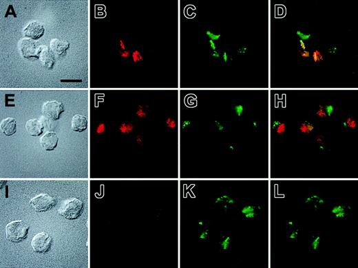 Figure 7. Subcellular localization of sTNFR1-tm and sTNFR1-tm-Y by immunofluorescence microscopy. Indirect immunolocalization of the TNF-R and a marker for secretory lysosomes, lgp120. The cells used were RBL cells transfected with sTNFR1-tm-Y (A-D), sTNFR1-tm (E-H), and wild-type RBL cells (I-L). The cells were fixed, permeabilized, and stained, as described in “Materials and methods,” before being attached to poly-lysine–coated coverslips and the images recorded. Briefly, the cells were incubated with a rabbit anti–lgp120 antibody and a mouse monoclonal antibody against the sTNFR1. Thereafter, the cells were stained with Alexa Fluor–labeled anti–rabbit and anti–mouse secondary antibodies. The localization of TNF-R and lgp120 is shown in red and green, respectively, whereas the rightmost images show an overlay of the red and green staining patterns. The corresponding Nomarski images also are shown. Results are representative of 4 separate experiments. Bar = 10 μM.