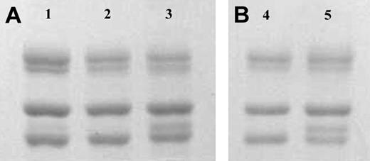 Figure 1. SDS-PAGE of fibrinogen γ-chain variants. Panel A shows unfractionated (Calbiochem; lane 1), γA/γA (lane 2), and γA/γ′ (lane 3) fibrinogen preparations purified by DE52 anion-exchange chromatography. From top to bottom, bands for theAα, Bβ, and γA chains can be observed. An additional band for the heavier γ′ chain migrates between the γA and Bβ chain in the γA/γ′ preparation as can be observed in lane 3 and 5, and more faintly in lane 1. Panel B shows γA/γA (lane 4) and γA/γ′ (lane 5) fibrinogen purified from one individual.
