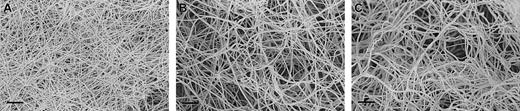 Figure 4. Scanning electron micrographs of clots made from fibrinogen γ-chain splice variants. Clots were made from purified fibrinogen γ-chain splice variants and observed by scanning electron microscopy. Scale bars indicate 2 μm. There is a marked difference in fiber size and density of clot, with thinner fibers and smaller pores for clots made from γA/γ′ fibrinogen (A) compared with the more frequent variant γA/γA (B). Unfractionated fibrinogen (C) produces clots with an appearance that is more similar to that of γA/γA.