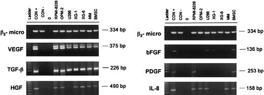 Figure 1. mRNA expression of proangiogenic factors by myeloma cells. RT-PCR was performed to test angiogenic factor mRNA expression by HMCLs (RPMI 8226, OPM-2, U266, XG-1, and XG-6), purified MM cells, and BMSCs obtained from patients. β2-Microglobulin was amplified as internal control. MG-63 was used as positive control (CON+) for bFGF, TGF-β, and HGF, whereas BMEC-60 was used for VEGF, PDGF and IL-8. MNCs from healthy subjects were used as negative control (CON-).