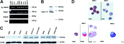 Figure 2. Angiopoietin system expression by HMCLs. Ang-1, Ang-2, Tie2, and β2-microglobulin mRNA expression by RPMI 8226, OPM-2, U266, XG-1, XG-6, and the EBV+ cell line ARH-77 were evaluated by RT-PCR. (A) Leukemia cell line K562 was used as positive control (CON+), and CD19+ from healthy subjects was used as negative control for all factors. (B-C) Ang-1 protein expression and secretion by HMCLs were checked by Western blot analysis and immunoprecipitation, respectively. Conditioned medium of XG-6 was incubated with 0.5 μg anti–Ang-1 antibody for 1 hour at 4°C. Then 20 μL Protein G PLUS-Agarose was added and incubated, with mixing for 2 hours at 4°C. After washing, immunoprecipitated material was recovered by boiling in sample loading buffer and was separated by electrophoresis. Silver staining was performed to detect the presence of soluble Ang-1 (B). XG-6 and RPMI 8226 (5 × 106) were incubated in the presence or absence of IL-6 (20 ng/mL) or VEGF (10 ng/mL) for 48 hours, and cell lysates were evaluated for Ang-1 expression by Western blot analysis, as described in “Patients, materials, and methods” (C). (D) Ang-1 and Ang-2 immunostaining in K562 (positive control) and in HMCLs. Ang-1 immunostaining was performed in U266 and K562 using the indirect immunoperoxidase method/DAB or in XG-6 and RPMI 8226 using the alkaline phosphatase method/new fuscin, as described in “Patients, materials, and methods.” Ang-2 immunostaining was performed in RPMI 8226 and K562 using the indirect immunoperoxidase method/DAB. Original magnification, × 100.