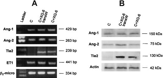 Figure 3. HMCLs up-regulate Tie2 expression by endothelial cells. Human BM endothelial cell line BMEC-60 (2 × 106) was cocultured in the presence or absence of a transwell system with HMCL (5 × 106) XG-6 in 6-well collagen-coated plates. After 24 hours, mRNA was extracted from BMEC-60 alone, in the control and transwell condition, or from pooled BMEC-60 and XG-6 in cell-contact condition. (A) Ang-1, Ang-2, and Tie2 expression were evaluated by RT-PCR, and ET-1 expression was used to document that an equal amount of endothelial cells was analyzed. (B) Ang-1, Ang-2, and Tie2 proteins were assessed by Western blot analysis after 48 hours. Figures are representative of 3 independent experiments (C indicates BMEC-60 control; transW, transwell; C+XG-6, contact coculture).