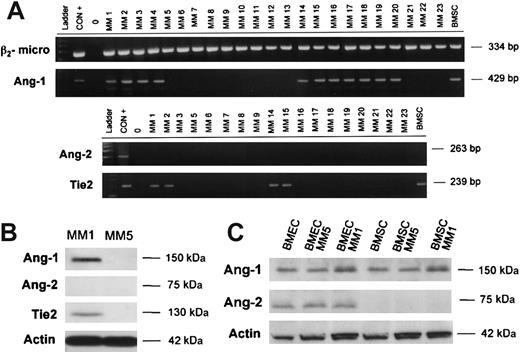 Figure 5. Angiopoietin system expression in patients with MM. Ang-1 mRNA expression was evaluated by RT-PCR in highly purified (more than 90%) MM cells obtained from 23 patients at diagnosis or relapse. (A) In 18 patients, Ang-2 and Tie2 mRNA expression were also tested. (B) Ang-1, Ang-2, and Tie2 protein production, evaluated by Western blot analysis immediately after immunomagnetic purification, are shown for 2 representative patients with MM (MM1, Ang-1–positive; MM5, Ang-1–negative). (C) Ang-1 and Ang-2 protein expression in a cell-contact coculture system with fresh MM cells and either BM endothelial cell line BMEC-60 (BMEC) or BM stromal cells (BMSCs).