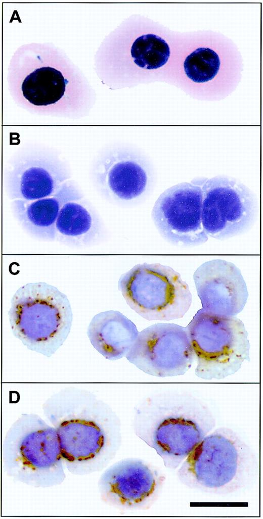 Figure 5. Expression of Nix and Bcl-xL protein in the erythroid precursor cells. Immunostaining was performed on cytospin preparations of primary human erythroid precursor cells (“Materials and methods”). (A) May-Grünwald-Giemsa staining of air-dried (unfixed) cytospin preparations to demonstrate erythroid maturity. (B) Cells were fixed and stained in the absence of a primary antibody (negative control). (C) Cells were immunostained with anti–Bcl-xL antibody. (D) Cells were immunostained with anti-Nix antibody. Peroxidase (rust)–tagged secondary antibodies were used for detection in panels B to D. Bar indicates 10 μm.