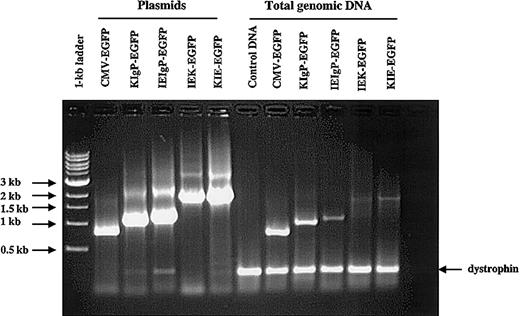 Figure 2. PCR amplification of promoter/enhancer elements of the vectors generated. To determine that all vectors were generated, 293T and MM1 cells were transduced with these vectors, expanded, and total genomic DNA extracted. The presence of lentivector sequences was determined by PCR using primers common to all the vectors generated (Figure 1). Plasmids used to generate the vectors were used as controls. To ensure that equal amounts of genomic DNA were used, 2 PCR primers that amplify a region of the human dystrophin gene were also included in the reaction mixture. The expected product is 230 bp in length. The PCR products were run on a 1% agarose gel and stained with ethidium bromide. The data shown are for 293T cells.