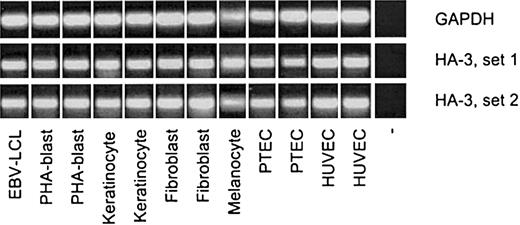 Figure 5. Tissue distribution of Lbc Expression of Lbc/AKAP13 was analyzed in various cell types using epitope spanning primers (HA-3, set 1) and intron spanning primers (HA-3, set 2) as described in “Patient, materials, and methods.” GAPDH-specific primers were used as positive control. A sample without DNA (–) functioned as negative control.