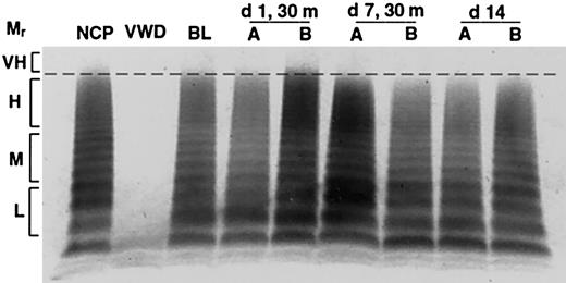 Figure 2. Release of very-high-molecular-weight VWF multimers by DDAVP but not rhIL-11. VWF multimers were separated on agarose gels and detected by immunostaining. Pooled plasma is shown for normal and homozygous VWD dogs in lanes NCP and VWD, respectively. The remaining lanes show samples drawn from C80, 1 of 2 normal dogs treated daily for 7 days with either rhIL-11 (50 μg/kg subcutaneously; lanes marked A), or DDAVP (5 μg/kg intravenously; lanes marked B). The plasma samples include baseline (BL), and days 1 and 7 at 30 minutes following treatment. Day 14 represents samples drawn 7 days after cessation of treatment. The relative multimer weights are indicated to the left of the gel: L, M, H, and VH indicate low, medium, high, and very-high-molecular-weight VWF multimers, respectively. Very-high-molecular-weight ratio (Mr) multimers are seen on day 1 with DDAVP treatment.